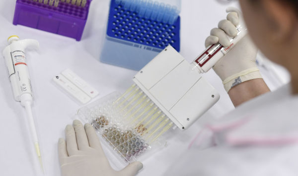Сотрудник лаборатории исследует образцы на коронавирус