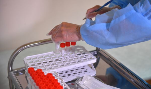 Пробирки с биоматериалом для теста на коронавирус